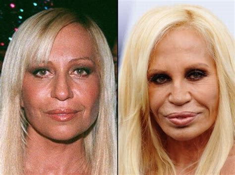 Top 10 celebrities with the best plastic surgery